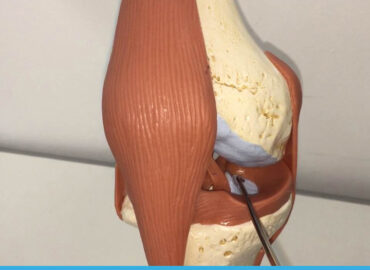 Biomeccanica del ginocchio