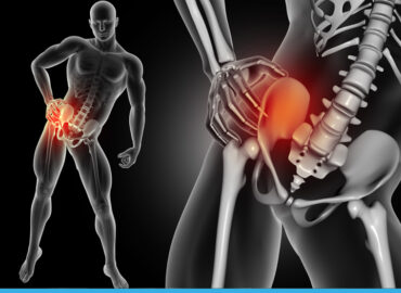 Protesi di anca, ginocchio e spalla: perché una protesi può fallire?