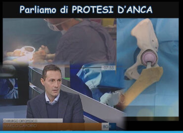 Parliamo di protesi d'anca