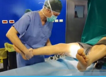 La nuova chirurgia protesica di ginocchio